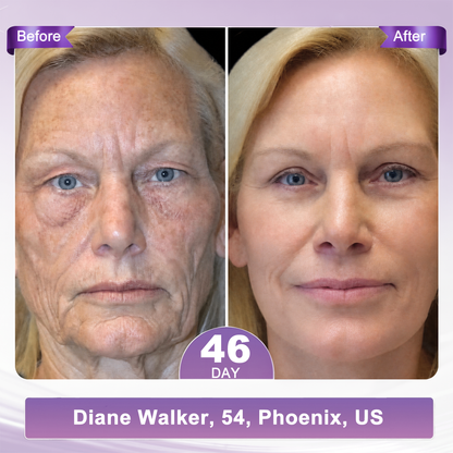 𝐏𝐃𝐑𝐍 𝐌𝐮𝐥𝐭𝐢-𝐏𝐞𝐩𝐭𝐢𝐝𝐞 𝐌𝐚𝐬𝐬𝐚𝐠𝐢𝐧𝐠 𝐁𝐨𝐝𝐲 𝐑𝐨𝐥𝐥𝐞𝐫 𝐂𝐫𝐞𝐚𝐦- Anti-aging, Hydrating, Skin Firming & Lifting, Skin Repair, Even Tone, Acne and Dark Spot Treatment, Wart and Mole Removal, and Psoriasis Relief.