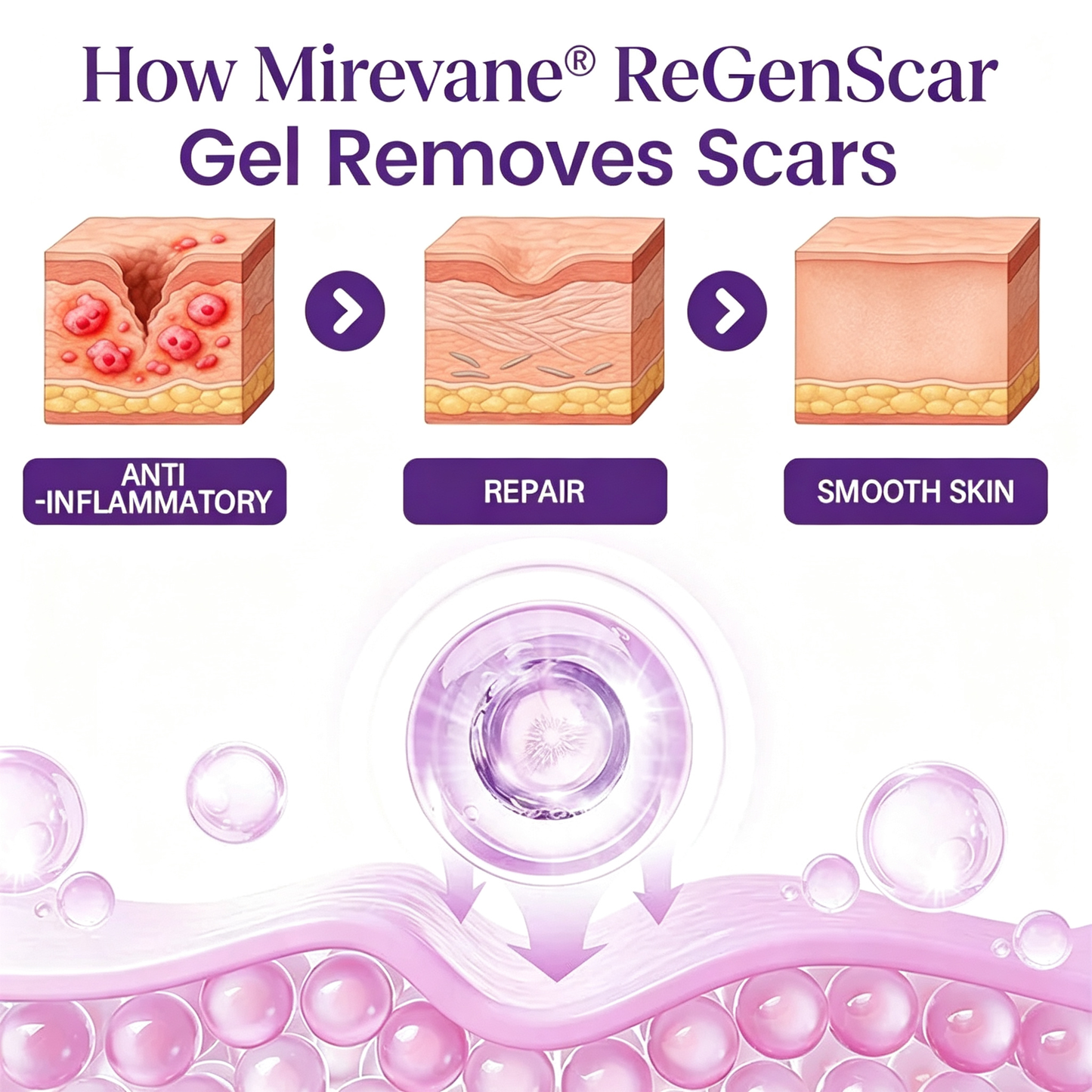 Mirevane® ReGenScar Stem Cell Scar Gel