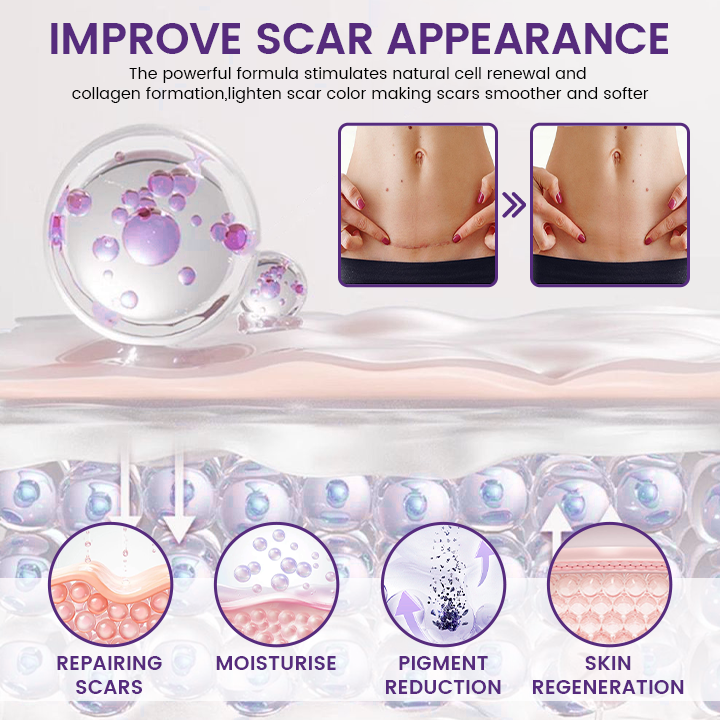 Mirevane® ReGenScar Stem Cell Scar Gel