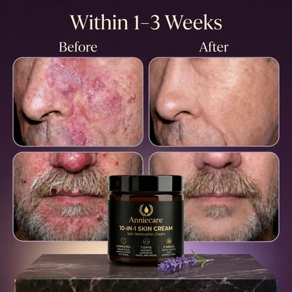 Anniecare 10-in-1 Skin Restoration Cream