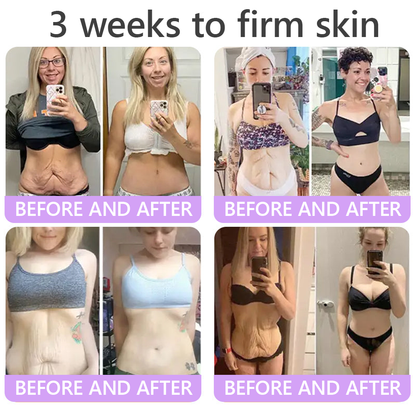 𝐏𝐃𝐑𝐍 𝐌𝐮𝐥𝐭𝐢-𝐏𝐞𝐩𝐭𝐢𝐝𝐞 𝐌𝐚𝐬𝐬𝐚𝐠𝐢𝐧𝐠 𝐁𝐨𝐝𝐲 𝐑𝐨𝐥𝐥𝐞𝐫 𝐂𝐫𝐞𝐚𝐦- Anti-aging, Hydrating, Skin Firming & Lifting, Skin Repair, Even Tone, Acne and Dark Spot Treatment, Wart and Mole Removal, and Psoriasis Relief.