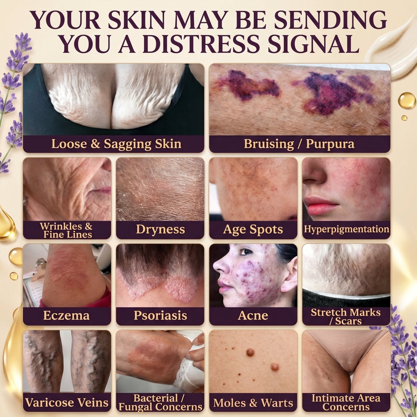 Anniecare 10-in-1 Skin Restoration Cream