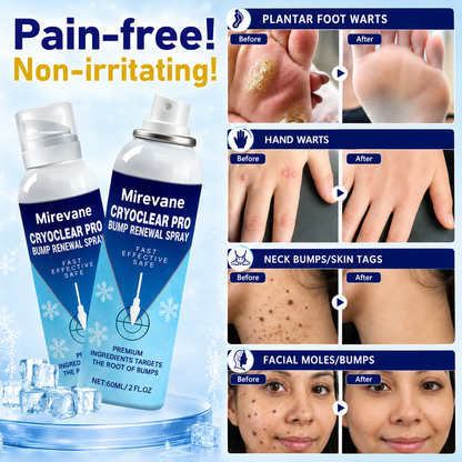 Mirevane CryoClear Pro Bump Renewal Spray